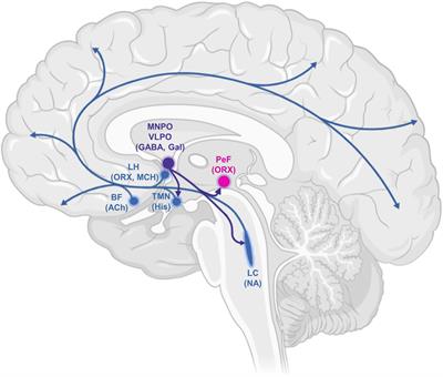 The Inert Brain: Explaining Neural Inertia as Post-anaesthetic Sleep Inertia